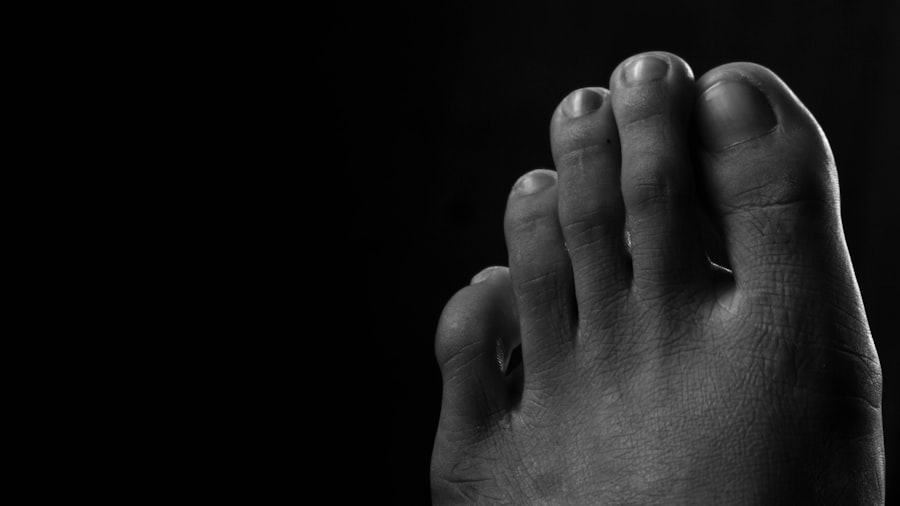 gout