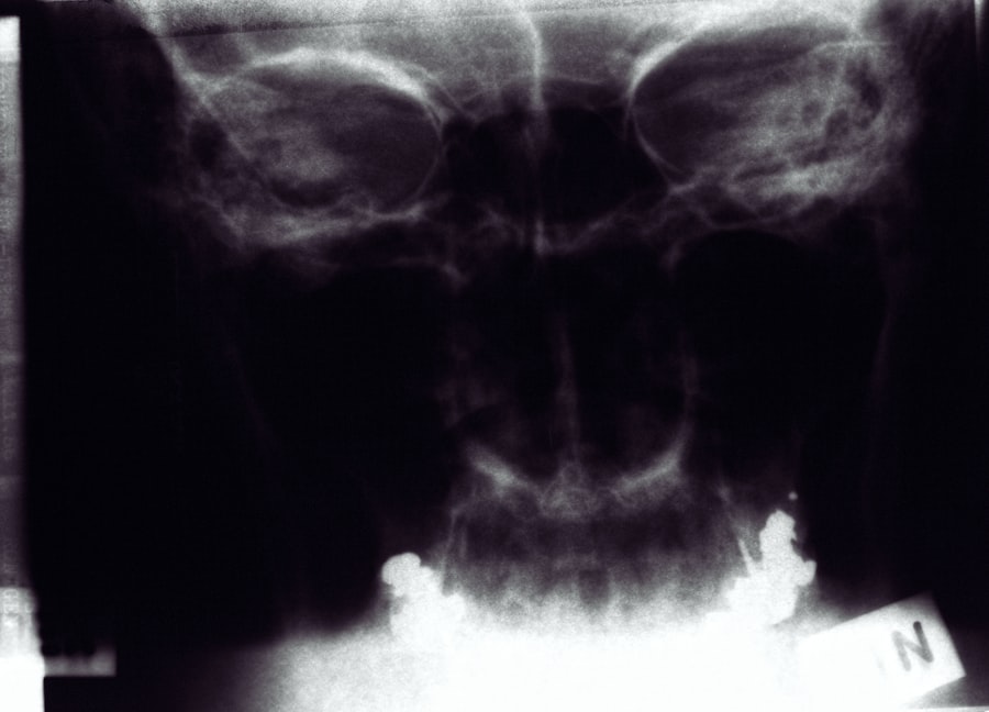 Photo gout diagnosis