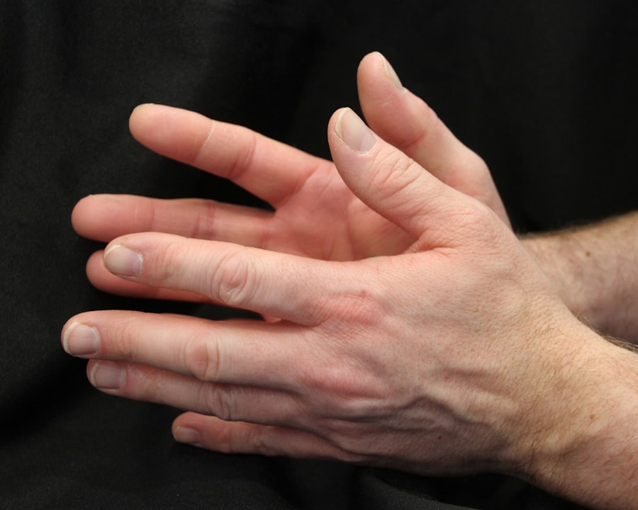 Photo gout symptoms